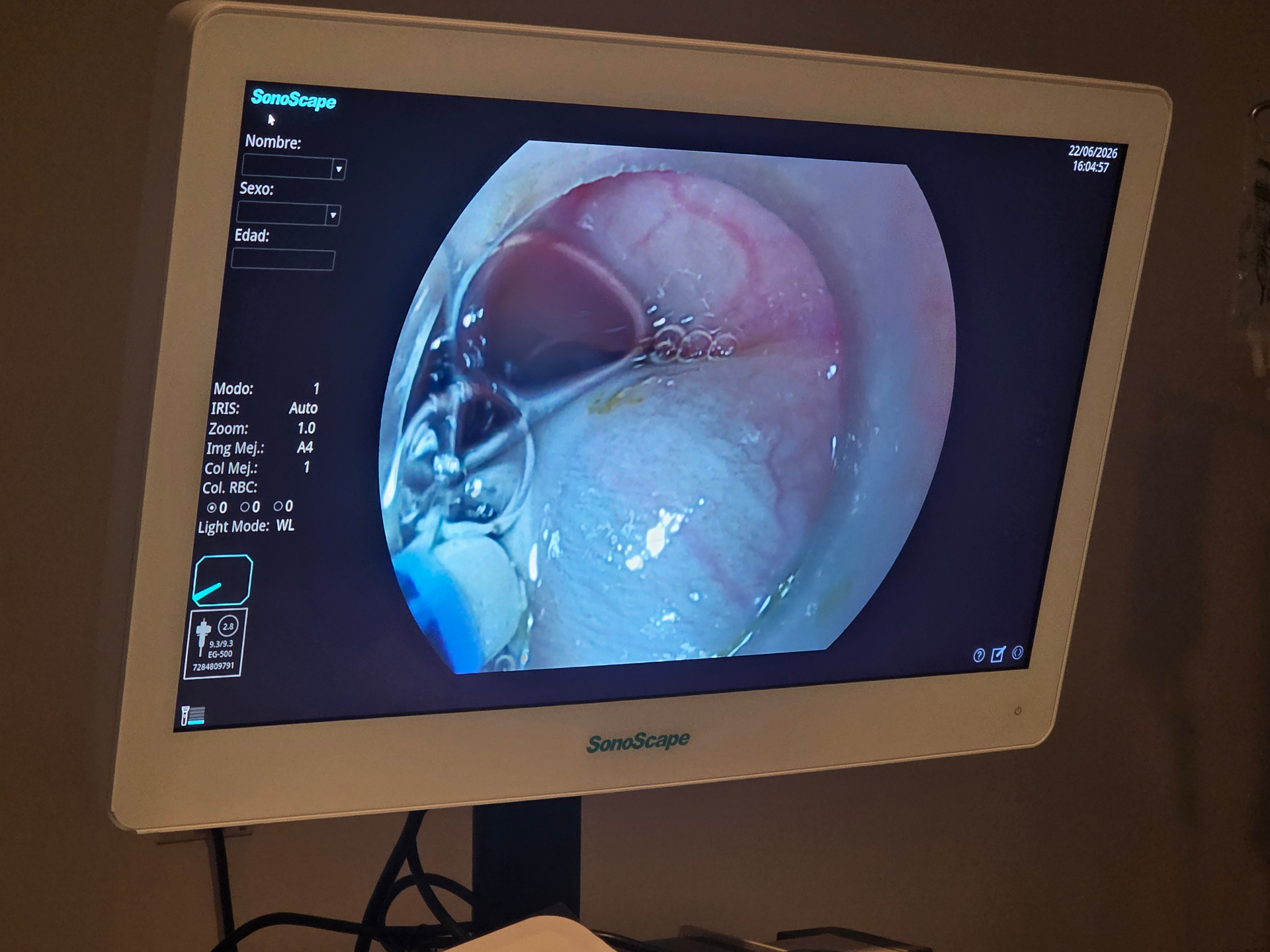 Detalle de la imagen endoscópica en el monitor del centro de simulación